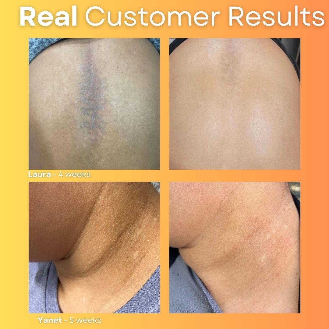 Glowing Kitty Kit + FREE Glow Wash