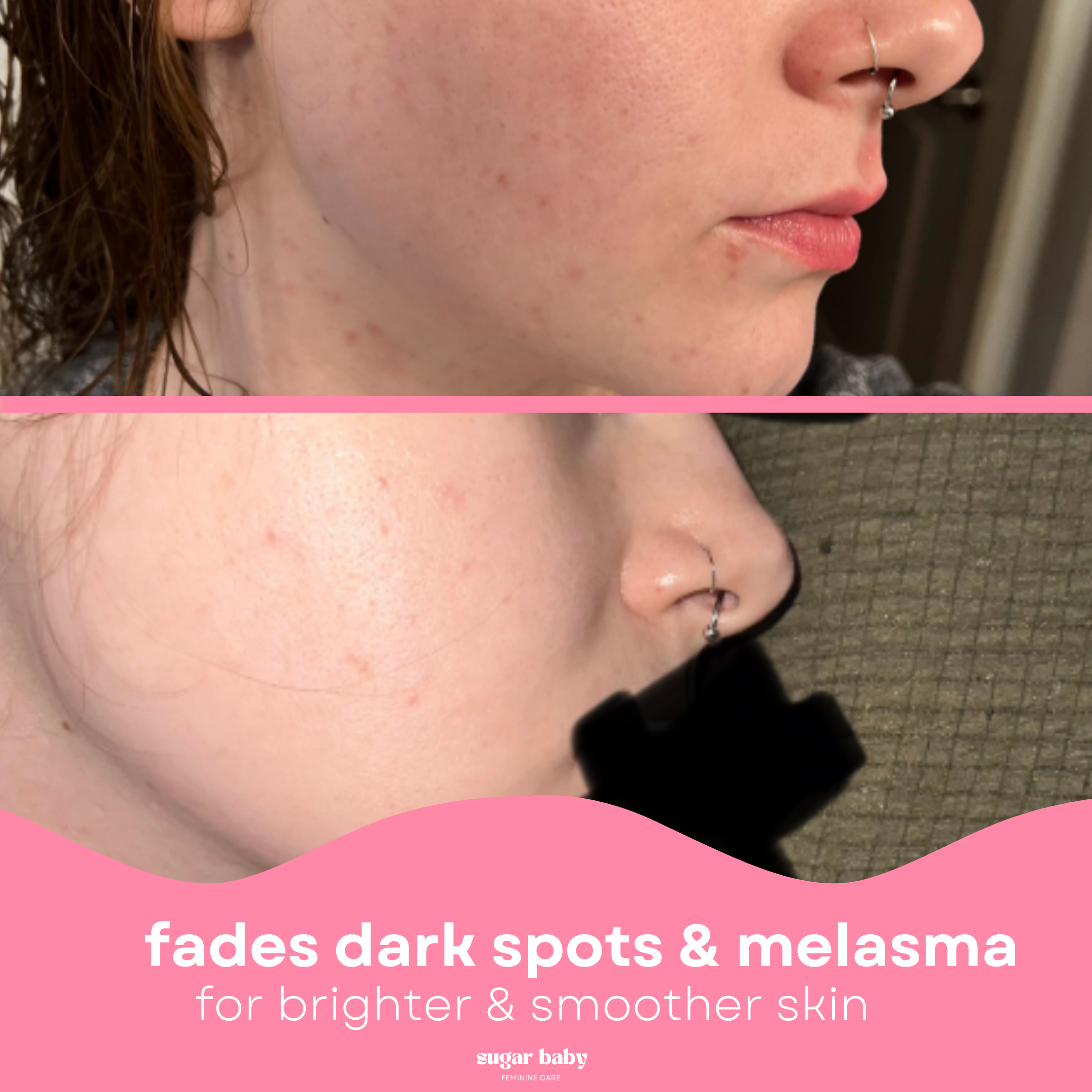 Glass Skin Kit + FREE Glow Serum