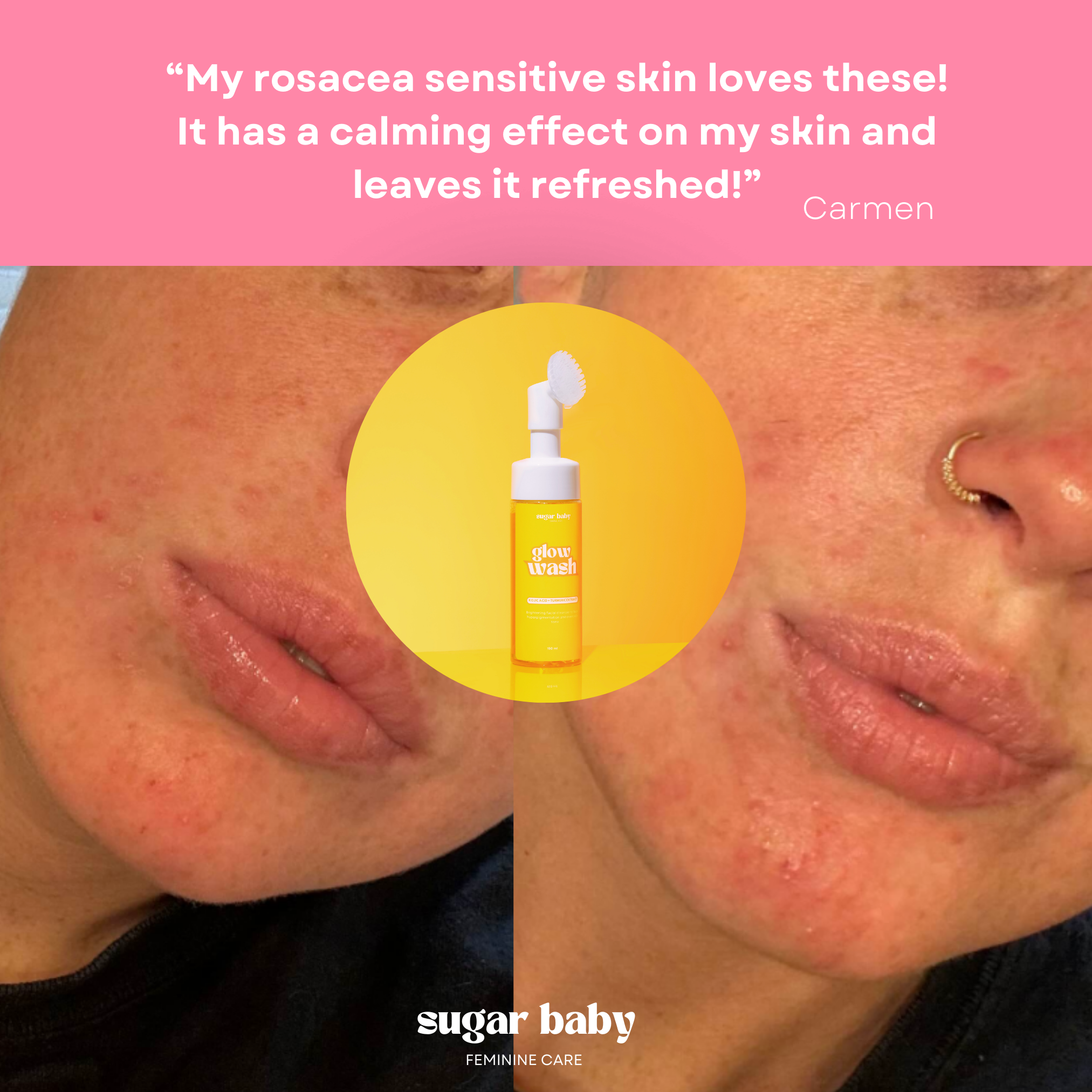 Glass Skin Kit + FREE Glow Serum