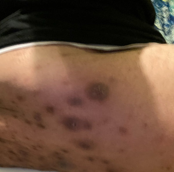 Before: Verified customer