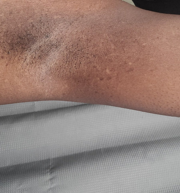 After: Lakisha