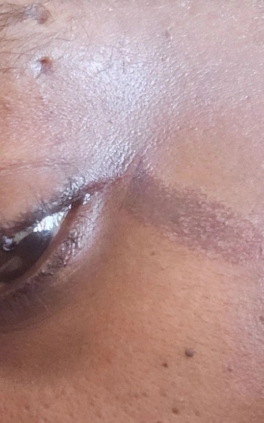 Before: Marquetta Turner