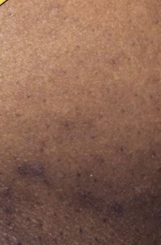 Before: Verified customer