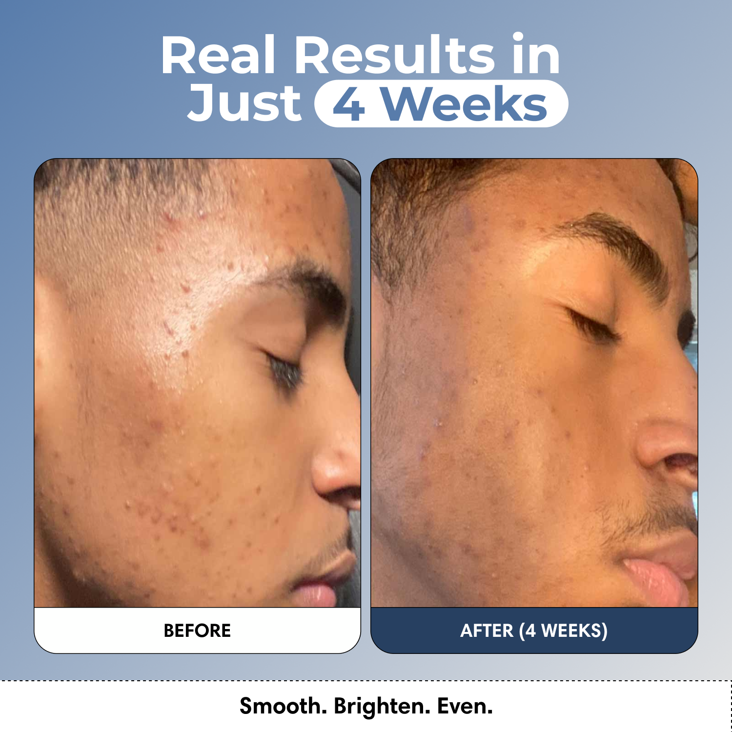 VIRAL Turmeric & Kojic Acid Glow Wash