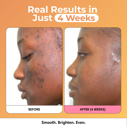 Brightening Lemon Turmeric & Kojic Acid Soap