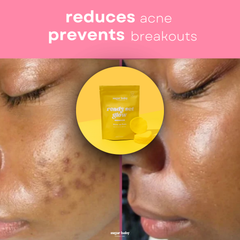 2 Glow Up Pads + FREE Glow Serum