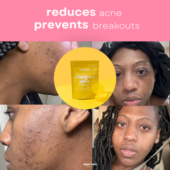 2 Glow Up Pads + FREE Glow Serum