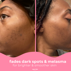 2 Glow Up Pads + FREE Glow Serum