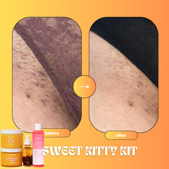 Sweet Kitty Kit - Brightens & Gets rid of Odor