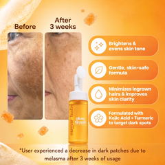 Turmeric & Kojic Acid Glow Wash