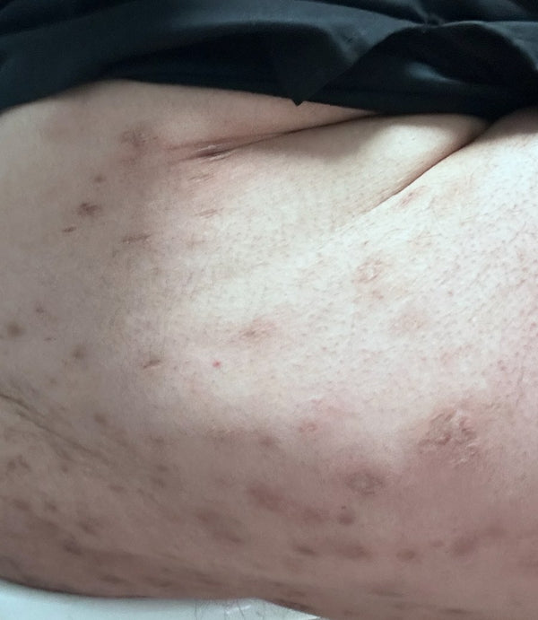 After: Verified customer