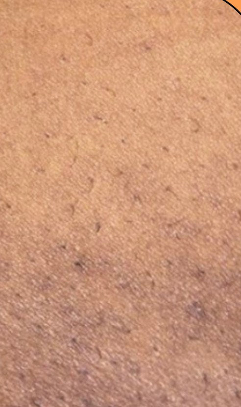 After: Verified customer